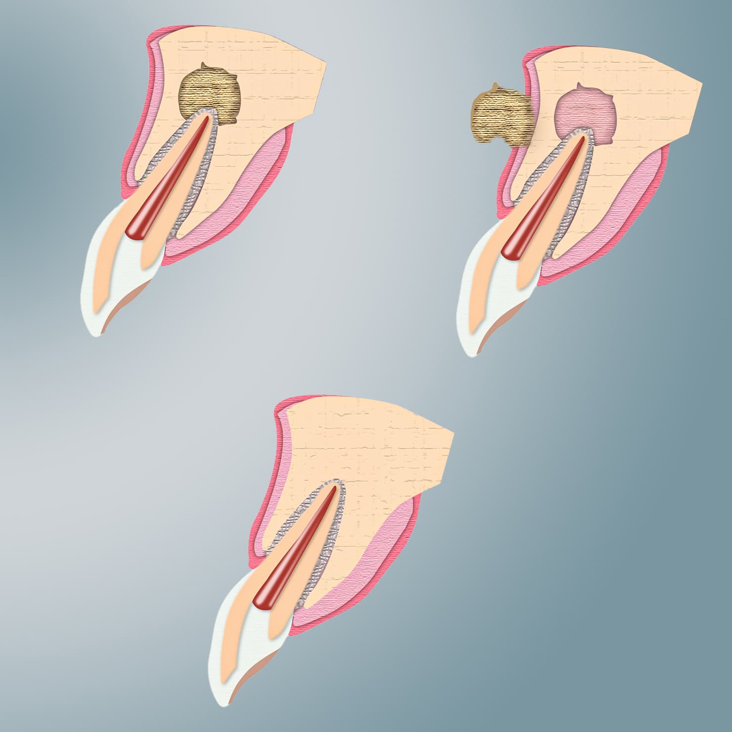 procedure